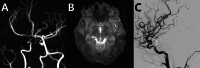 Fig. 15
