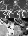 Fig. 10
