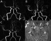 Fig. 14