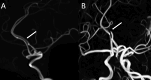 Fig. 13