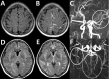 Fig. 16