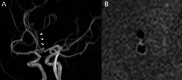 Fig. 12