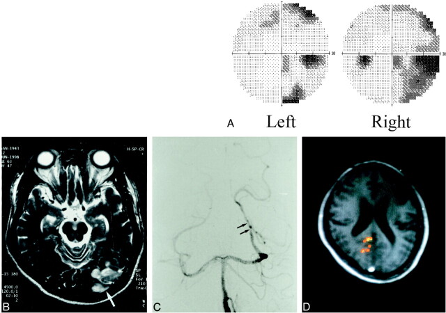 fig 1.