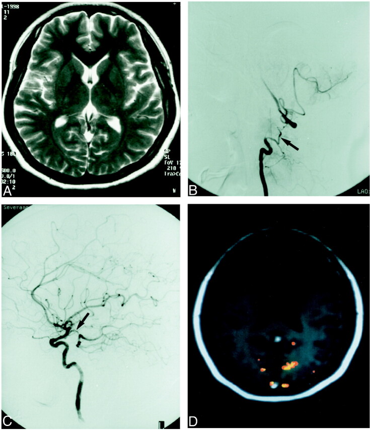 fig 3.