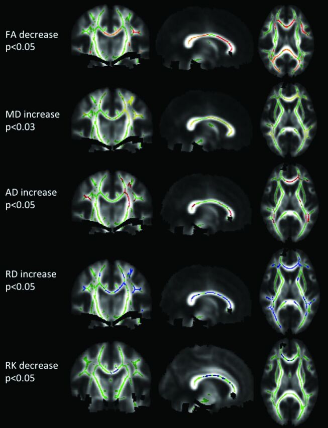 Fig 2.