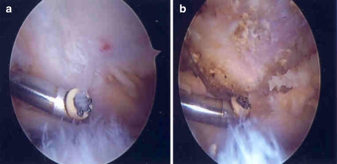 Fig. 3