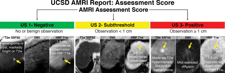 Standardized reporting of abbreviated MRI (AMRI) for HCC surveillance with hepatobiliary contrast agent. Abbreviated MR images show various findings (arrows).