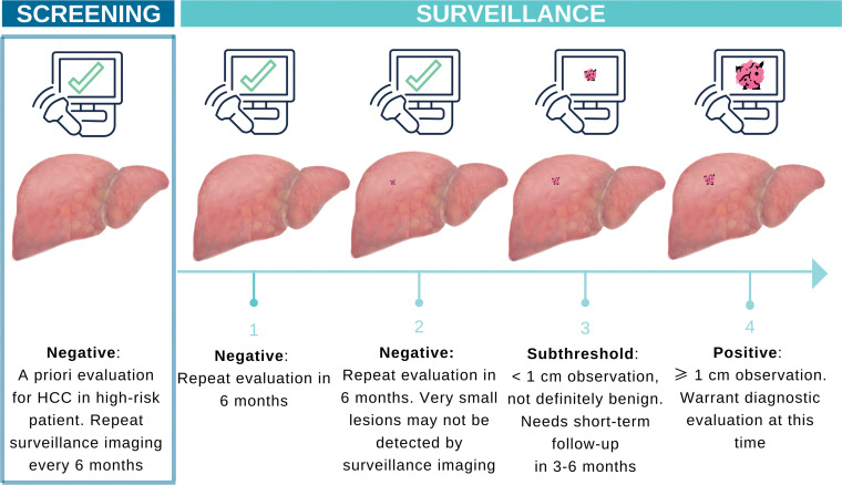 Illustration shows the differences between HCC screening and surveillance. Cancer surveillance involves screening examinations that are repeated at regular intervals in patients at high risk for HCC. HCC surveillance with US is repeated every 6 months because US lacks high sensitivity, especially for small early-stage cancers. If adherence to the surveillance schedule is maintained, US may allow detection of a previously missed lesion when the lesion reaches a more conspicuous size at follow-up.