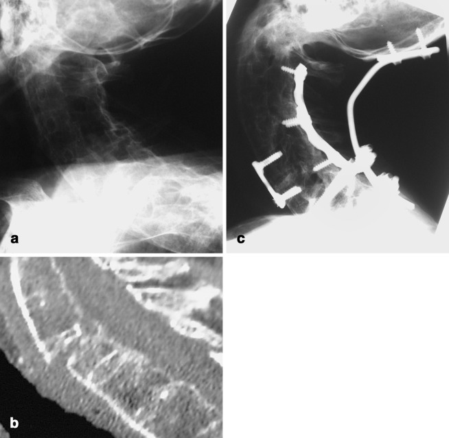 Fig. 2