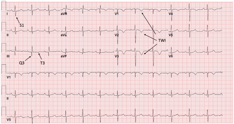 Figure 1