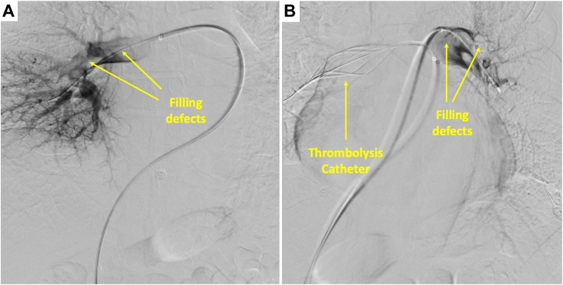 Figure 4