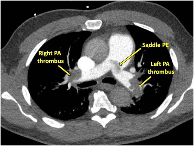 Figure 3