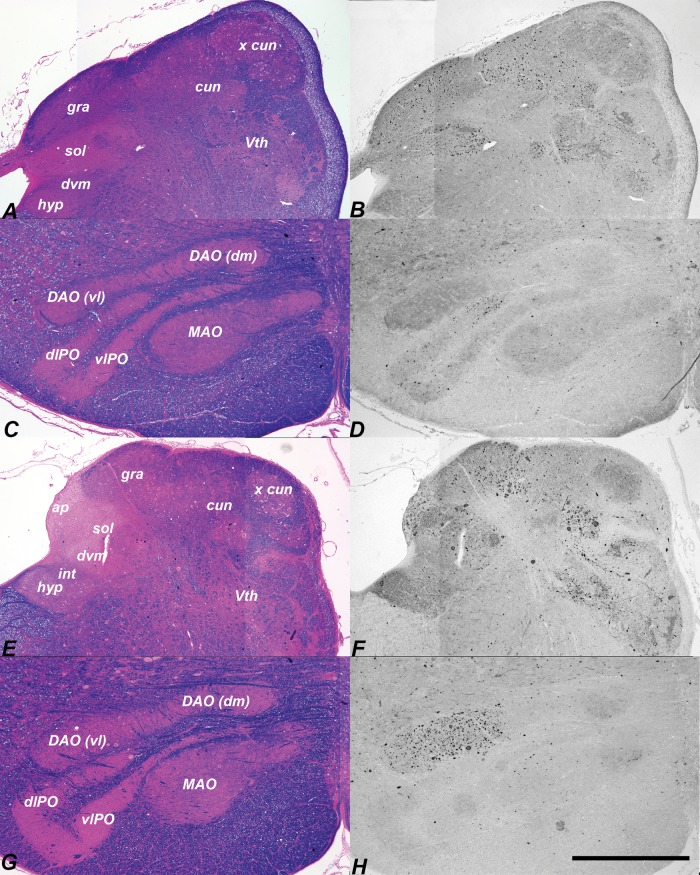 FIGURE 11.