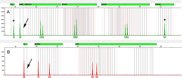 Fig. 11