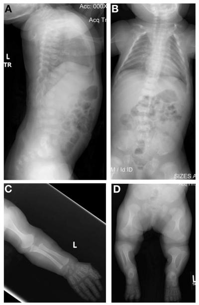 FIG. 1