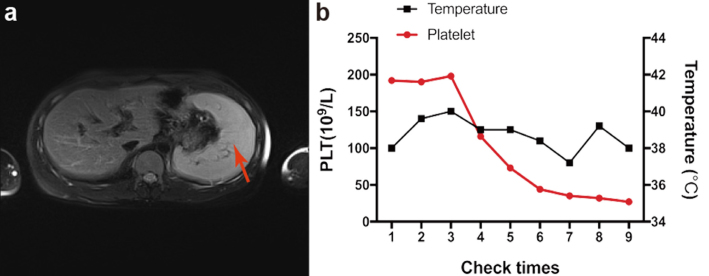 Figure 2. a, b