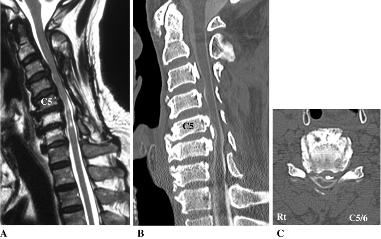 Fig. 1