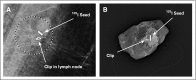 Fig 3.