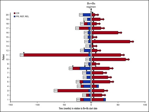 Brentuximab Vedotin Followed By Bendamustine Supercharge For Refractory 