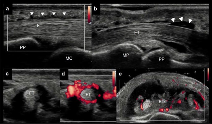 Fig. 2