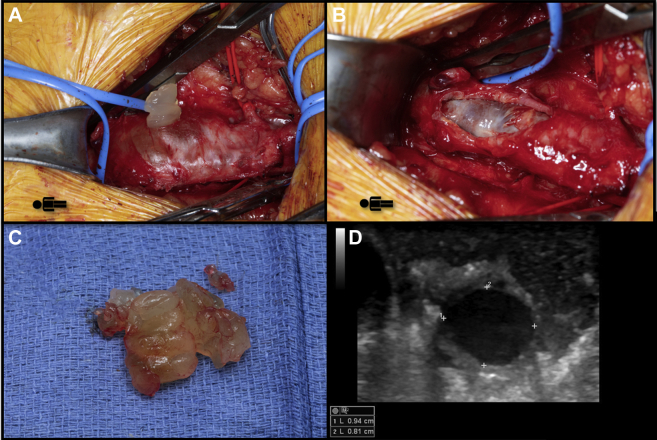 Fig 3