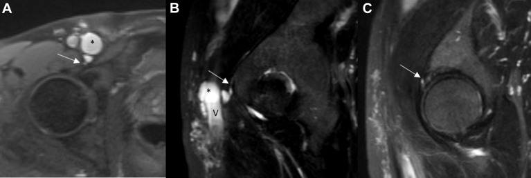 Fig 1