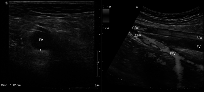 Fig. 1
