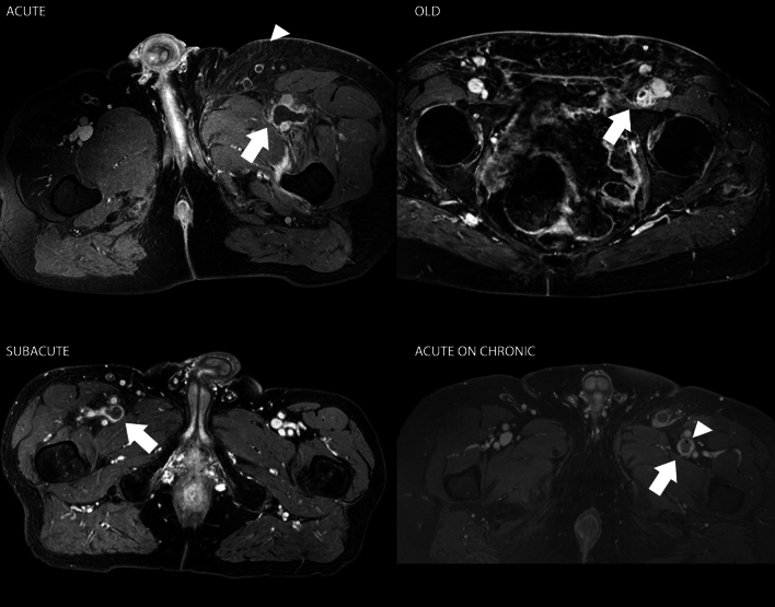 Fig. 7