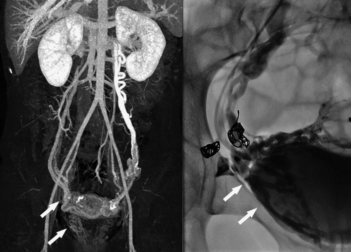 Fig. 11