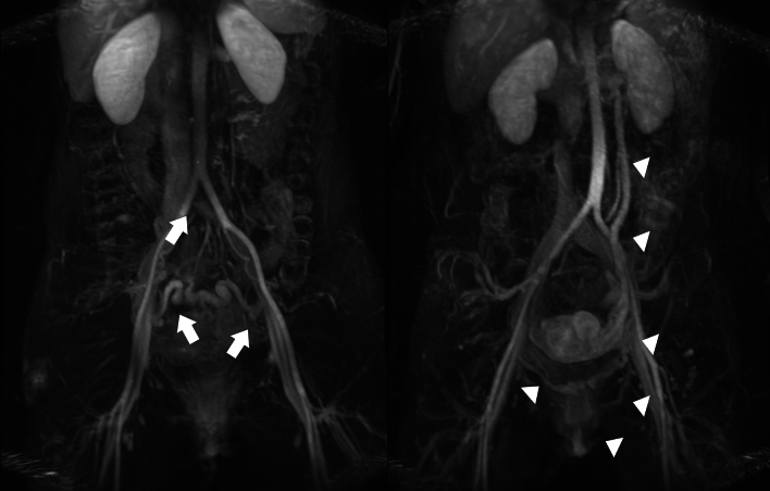 Fig. 15