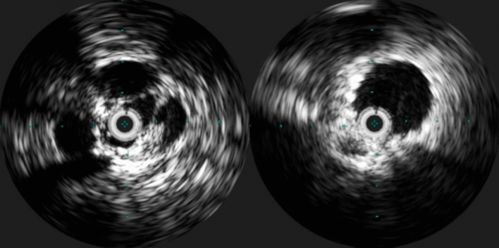 Fig. 9