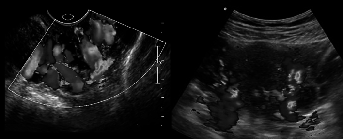 Fig. 13