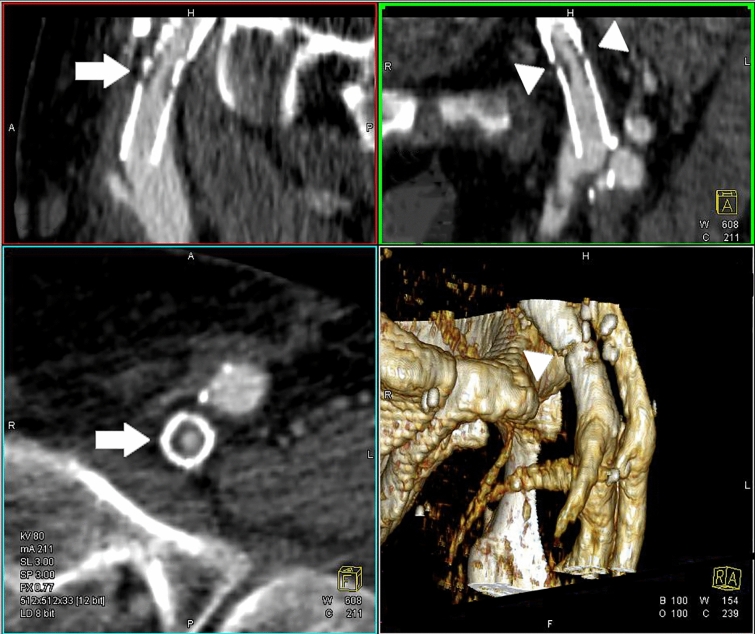 Fig. 6