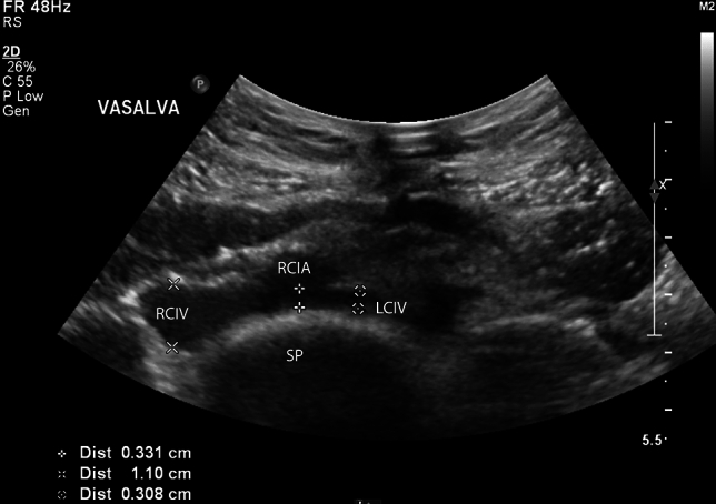 Fig. 2
