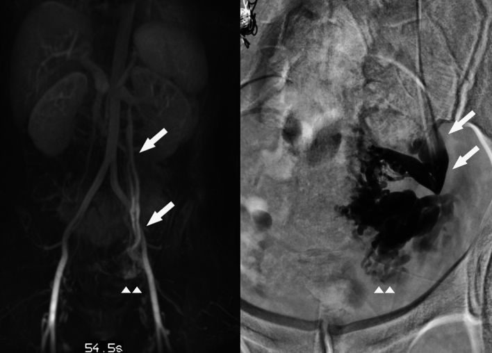 Fig. 14
