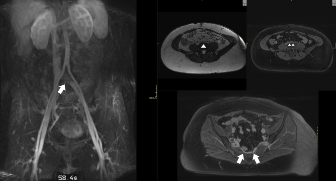 Fig. 12