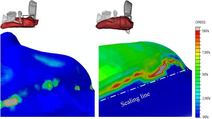 Figure 9