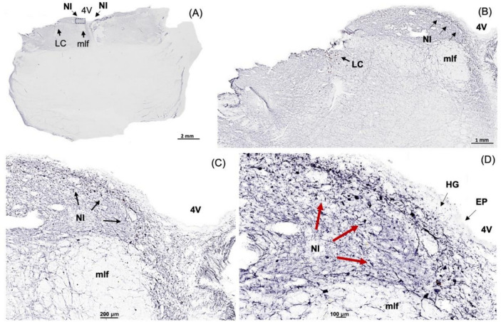 Fig. 4