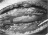 249