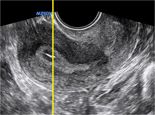 Fig. 1