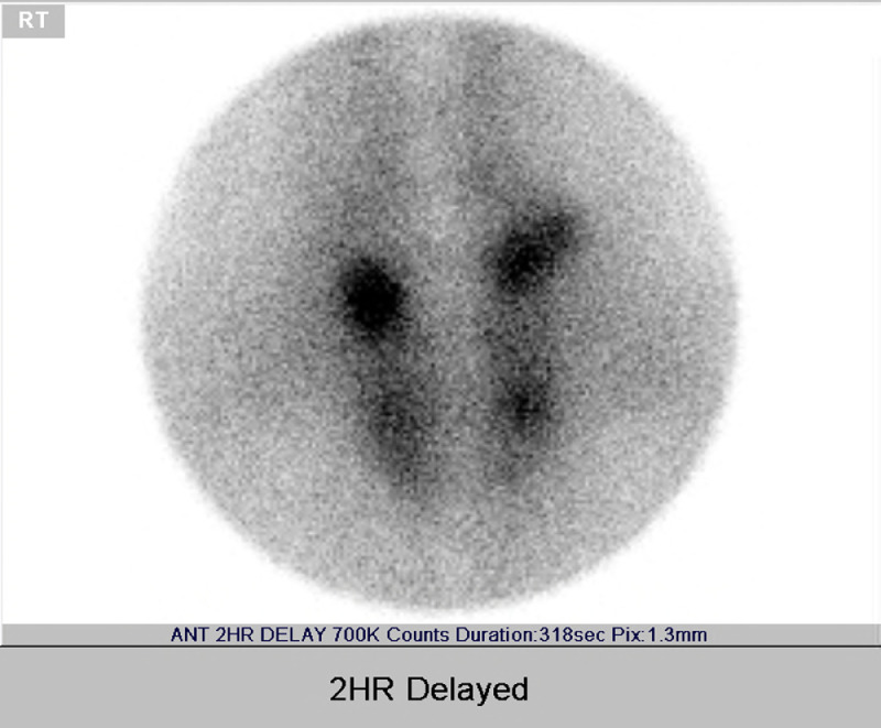 Fig 1 –