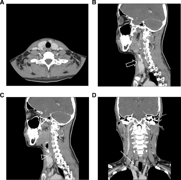 Fig 3 –