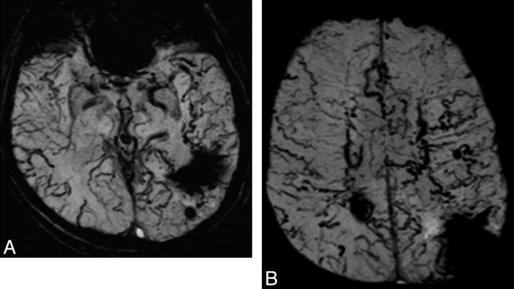 Fig 1.