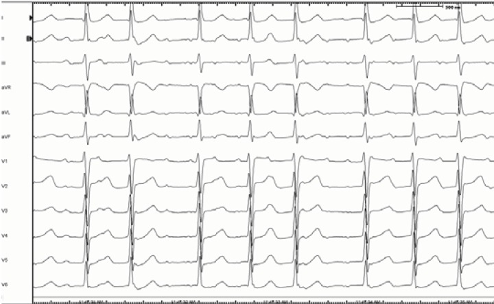 Fig. (2)