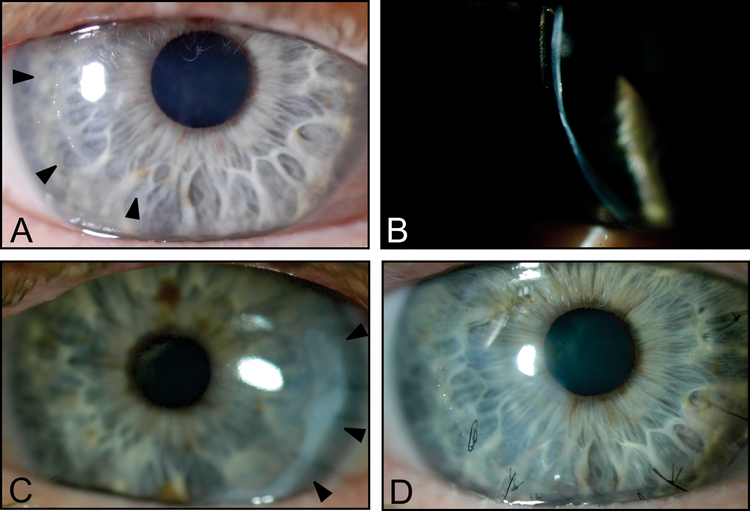 Figure 2: