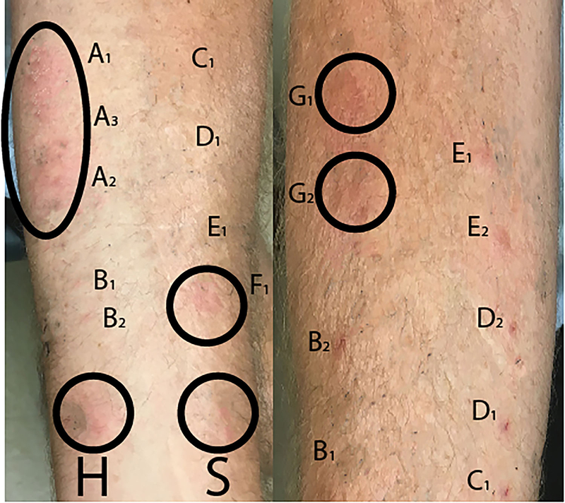 Figure 2: