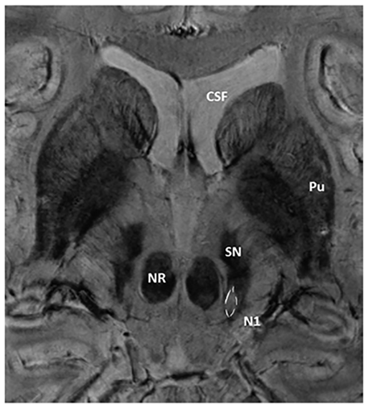 Fig 1