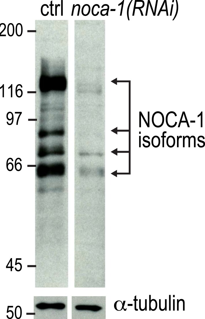 Figure 1—figure supplement 2.