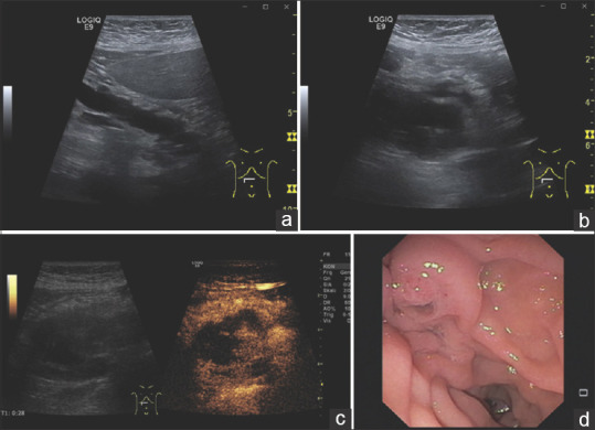 Figure 11