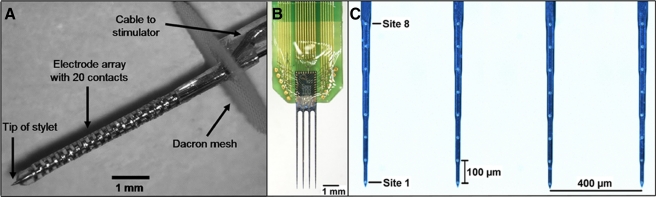 FIG. 1